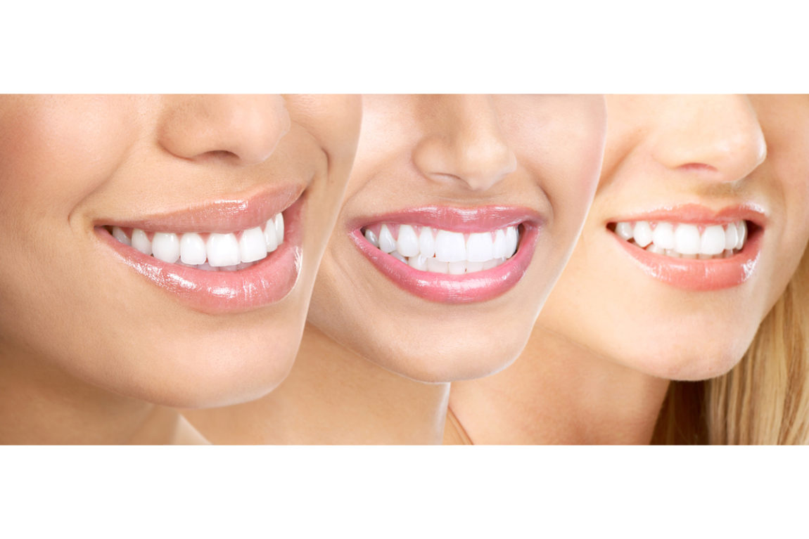 reflection-dental-guam-white-smiles.jpg