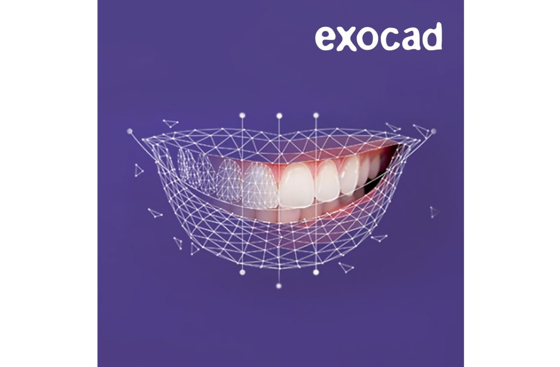 exocad-smile-creator-1.jpg