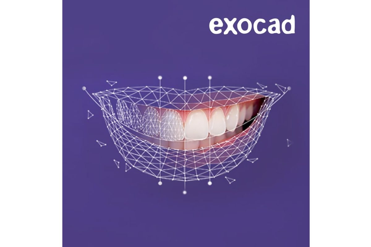 exocad-smile-creator exocad-smile-creator